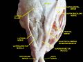 Supratrochlear nerve