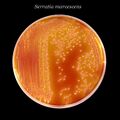 Serratia marcescens 01