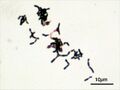 Bifidobacterium adolescentis Gram