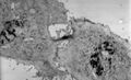 Cytokinesis electron micrograph