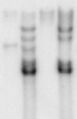 Autoradiogram of a Southern blot