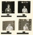 Guatemala syphilis experiments