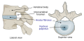 Intervertebral disc