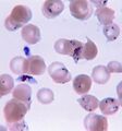 Plasmodium