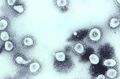 Human coronavirus OC43