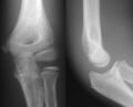 Projectional_radiography