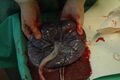 Placenta held