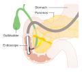 Prostaglandin inhibitors
