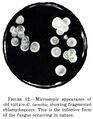 Microscopic view of Coccidioides immitis