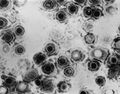 Neonatal_meningitis