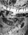 Ultrastructure of tracheal hemidesmosomes in mice