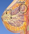 Breast cancer classification
