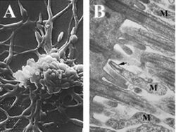 Mycoplasma pneumoniae cells attached to ciliated mucosal cells
