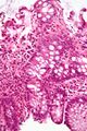 Cryptitis high magnification