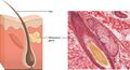 Sebaceous Glands