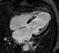 Cardiac magnetic resonance imaging