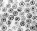 HIV/AIDS denialism
