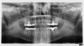 Panoramic radiograph