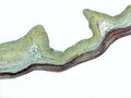 Movat's stain