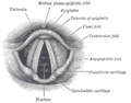Vestibular fold