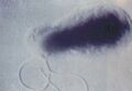 Bartonella bacilliformis