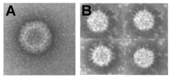 Negative contrast electron micrograph of CTF virus