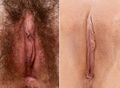 Labia