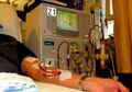 Dialysis access in arm