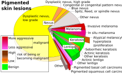 Pie chart of incidence and malignancy of pigmented skin lesions