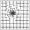 Amsler grid as seen by a patient with AMD