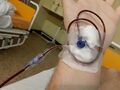 Packed red blood cells