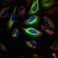 Multicolor fluorescence image of living HeLa cells