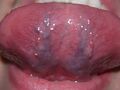 Facies inferior linguae