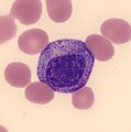 White blood cell differential