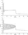 Diagram illustrating myotonia