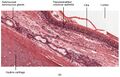 Detailed image of the trachea.