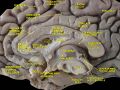 Longitudinal fissure