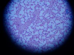 Streptococcus group B