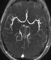 Magnetic resonance angiography