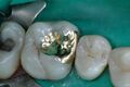 Glossary of dentistry