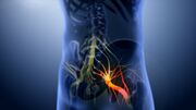 3D still showing Sciatica nerve