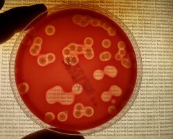 Beta hemolysis on blood agar