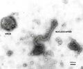 Hendra Virus