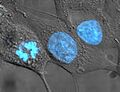 HeLa cells stained with Hoechst 33258