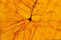 Parasol cell