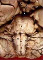 Anterior view of the human brainstem
