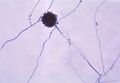 Aspergillus niger