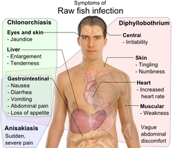 Symptoms of Raw fish infection