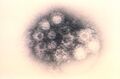 Coxsackie A virus