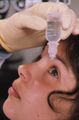 An eye drop being administered